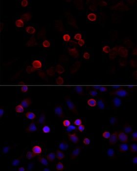 FLNC Antibody