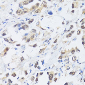 EP300 Antibody