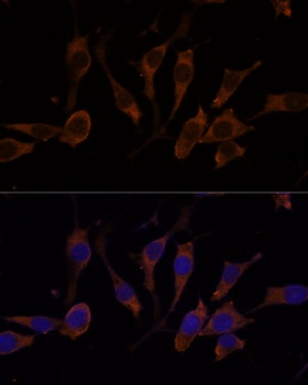 RPL32 Antibody