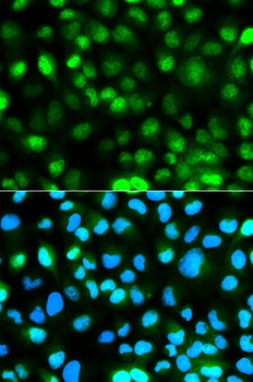 ATXN3 Antibody