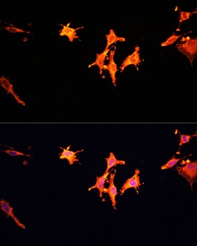 MST1 Antibody