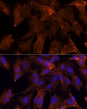 PGK2 Antibody