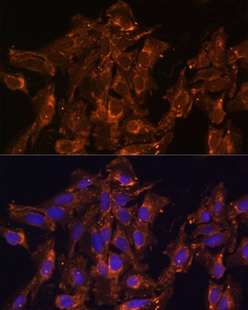 HSD17B8 Antibody