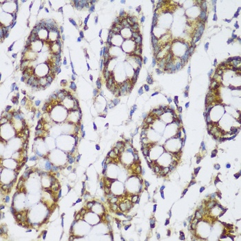 ECH1 Antibody