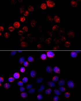 ECH1 Antibody