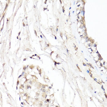 CDK7 Antibody