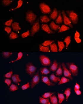 CDK7 Antibody
