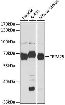 TRIM25 Antibody