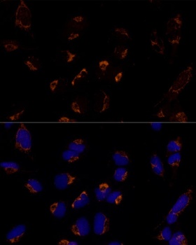 MTCH2 Antibody