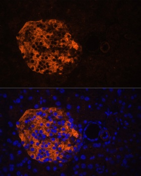 PNLIPRP2 Antibody