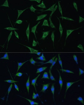 PALD1 Antibody