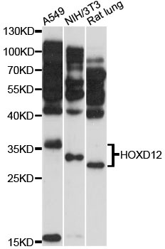 HOXD12 Antibody
