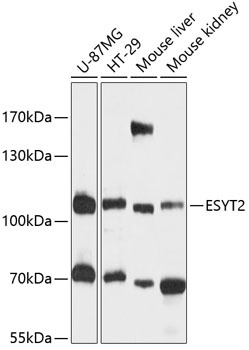 ESYT2 Antibody