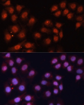 CDK11B Antibody