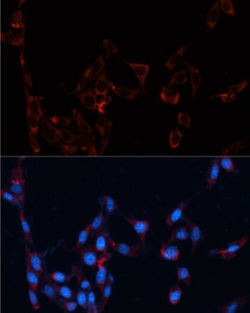 GPC4 Antibody