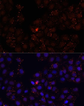 WDR81 Antibody