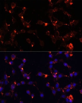 WDR81 Antibody