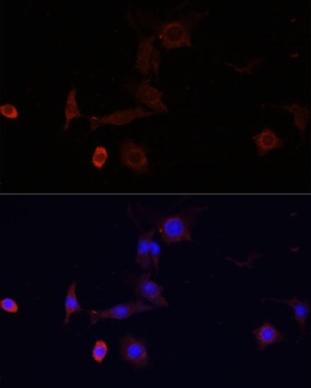 WDR81 Antibody