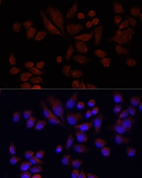 NAT2 Antibody