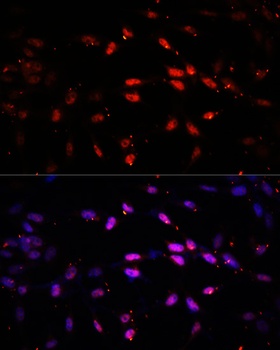 Kdm6b Antibody