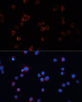 TH Antibody
