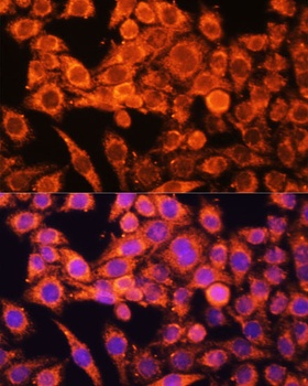 AMPKa1/AMPKa2 Antibody