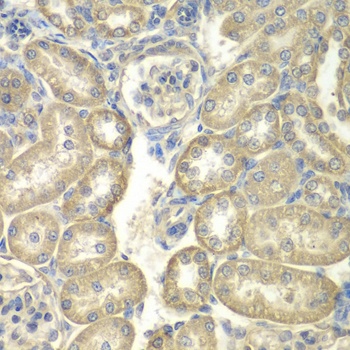 ACSL5 Antibody