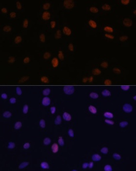 PSME3 Antibody