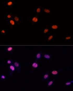 PSME3 Antibody