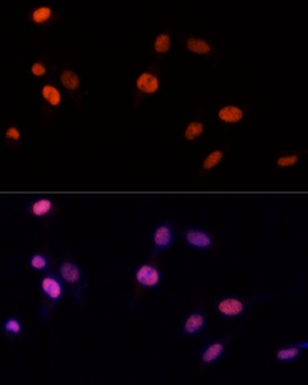 PSME3 Antibody