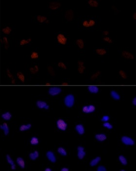 PSME3 Antibody