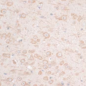 HMGA1 Antibody