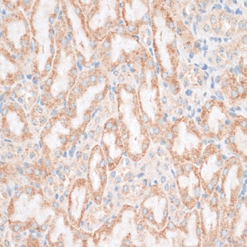 HMGA1 Antibody