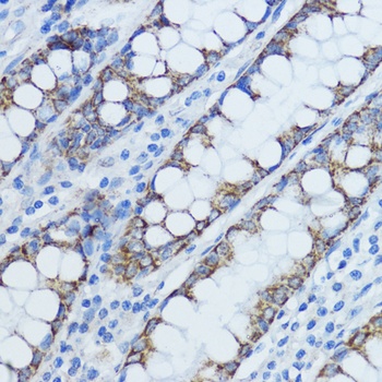 Aromatase Antibody