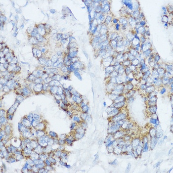 CYP19A1 Antibody