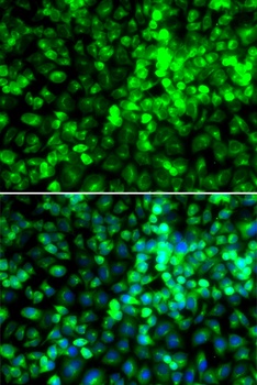 CYP19A1 Antibody