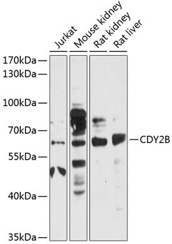 CDY2B Antibody