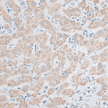 ACADL Antibody