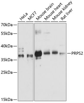 PRPS2 Antibody