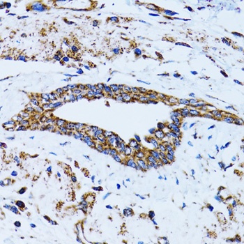 EIF2AK4 Antibody