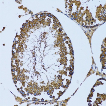 EIF2AK4 Antibody