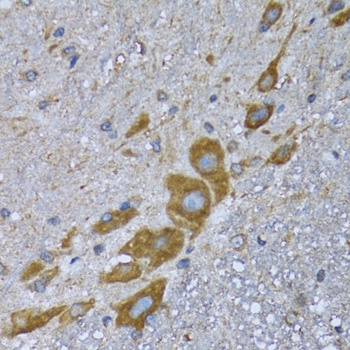 EIF2AK4 Antibody