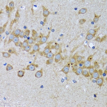 EIF2AK4 Antibody