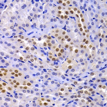 EIF2AK4 Antibody