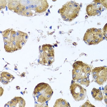 TUBB8 Antibody