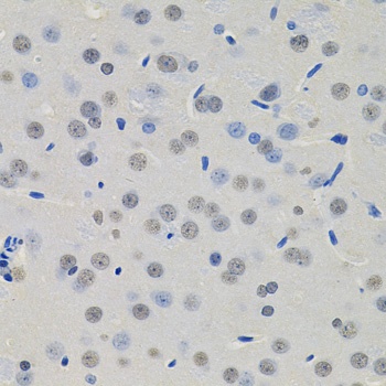 MKL1 Antibody