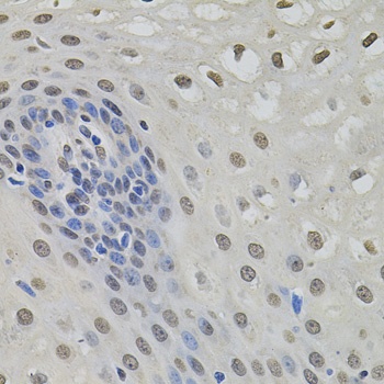 MKL1 Antibody