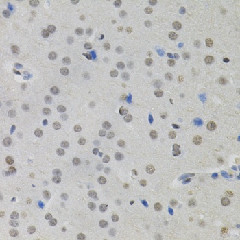 MKL1 Antibody