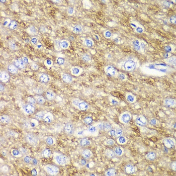 ARFGAP1 Antibody