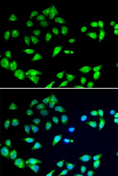 ARFGAP1 Antibody